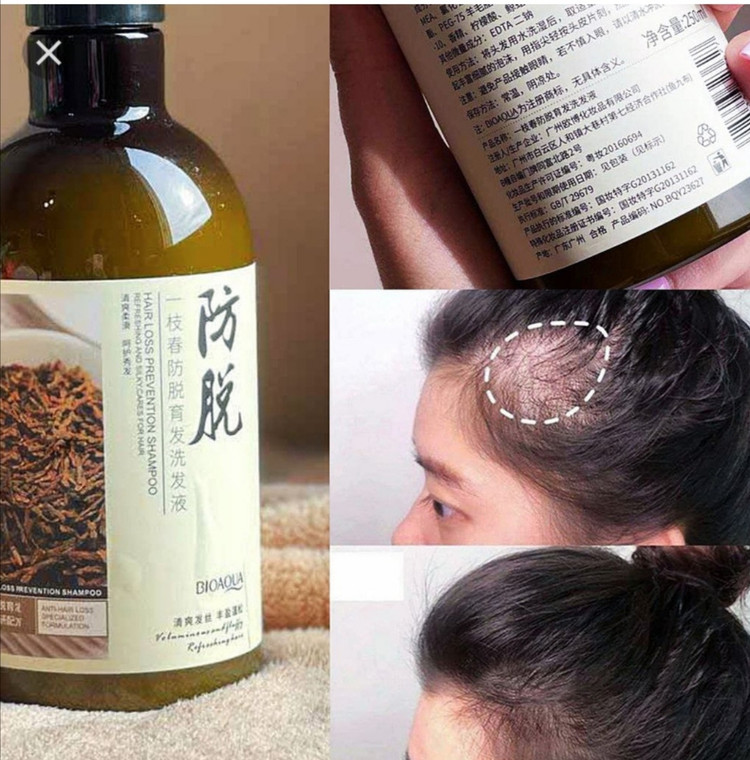 شامپو تخصصی رزماری